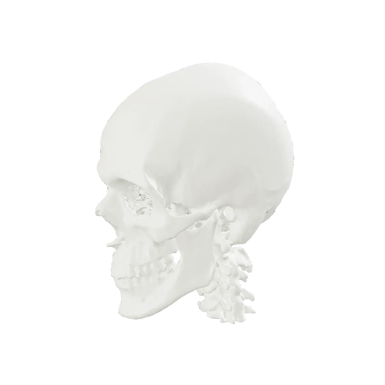 CT-derived 3D anatomical skull model, the same geometry we print for presurgical planning
