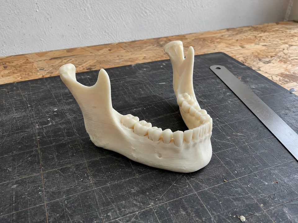 Printed mandible model