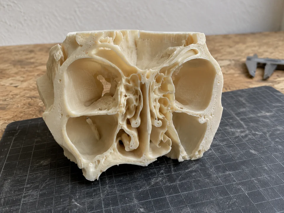 Printed sinus and skull-base model