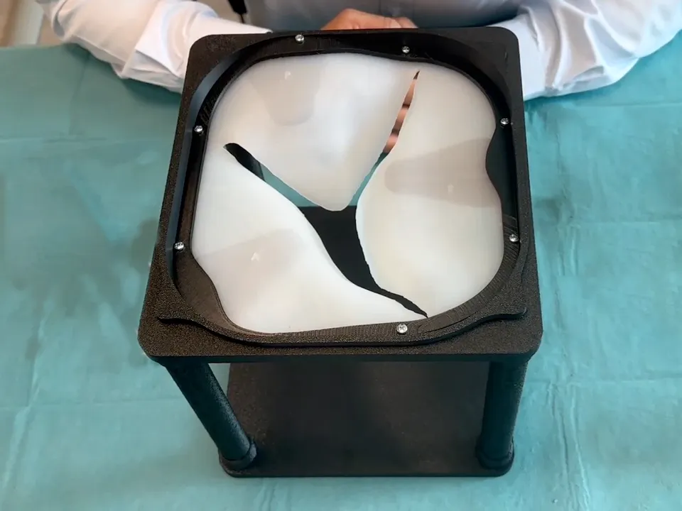 Our mitral valve simulator: a silicone valve in a black printed frame